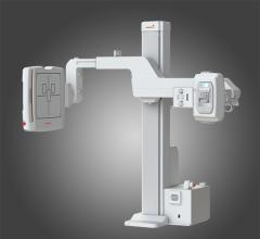 Rayence, RU-3000, U-arm, 1417 C-Series detectors, AHRA 2015