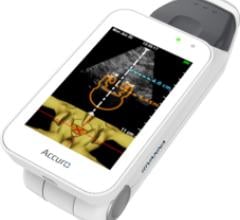 Accuro, handheld ultrasound, Rivanna Medical, spinal anesthesia guidance, FDA