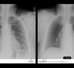 ClearRead Software Improve X-ray Images