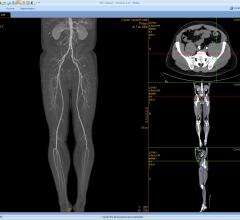 Shina Systems, 3Di PACS, version 3.2, RSNA 2015