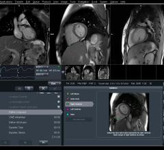 Data Science Bowl, second annual, algorithm, heart disease diagnosis