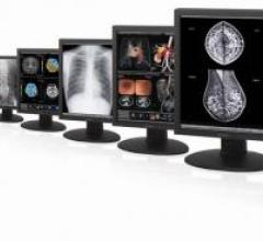 Monitors Inc. Sony High-Resolution Diagnostic Displays Mammography Systems