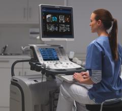 Ultrasound systems, RSNA 2014, Aplio 300 and 500 Platinum series