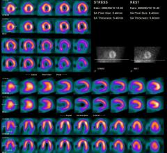 UltraSPECT, 450th U.S. installation, Firelands Regional Medical Center, nuclear medicine, radiation safety