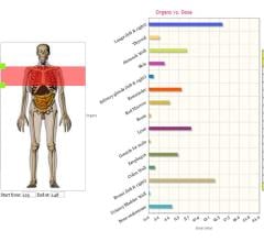 Medsquare, VirtualDose CT module, organ dose calculation, DACS Radiation Dose Monitor, RDM