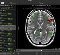 Visage Imaging, Visage Ease Pro, FDA clearance