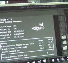 Frost & Sullivan Recognizes Volpara for Identifying Importance of Dose Tracking and Quantitative Analytics in Early Breast Cancer Detection