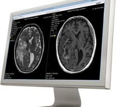 SyntheticMR, MRI software, SyMRI, REMyDI, automatic myelin volume measurement, RSNA 2016