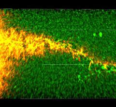 ultrasound-activated microbubbles, heart attack, pig model, NIBIB, human clinical trials