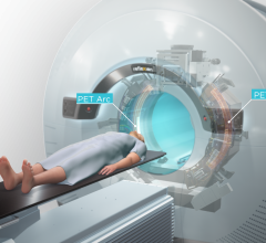 MERCK and RefleXion Medical announced a collaboration to evaluate KETRUDA (immunotherapy) with biology-guided radiotherapy - BgRT -  a new radiation machine developed to treat all stages of cancer.