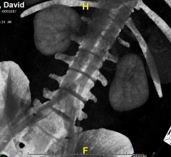 radiography, medical imaging influenced by malpractice liability, influence of tort reform on medical imaging orders