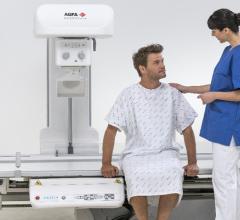 Agfa HealthCare Previews DR 800 Multipurpose DR System at RSNA 2017