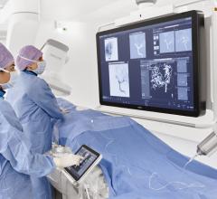 Philips announced its next-generation Philips Azurion image-guided therapy platform, marking an important step forward in optimizing clinical and operational lab performance and expanding the role of image-guided interventions in the treatment of patients.