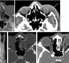 Radiology Offers Clues in Cases of Domestic Abuse and Sexual Assault