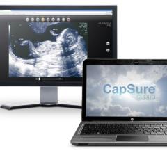 GlobalMed CapSure Cloud CT Systems Radiation Dose Management Clinical Decision