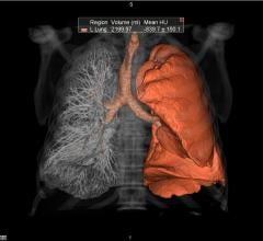 ACR MedCAC Medicare Coverage for CT Lung Cancer Screening