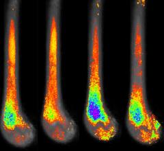 Imaging Fat of the Bone