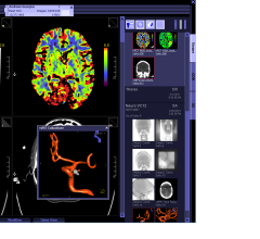 IT Lightens the Chains of Radiology