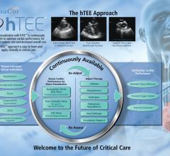 hTEE 24/7 Clinical Support Program ImaCor 