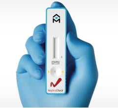 Nephrocheck Test System, Blood testing, contrast media