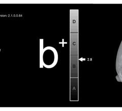 iCAD Receives FDA Clearance of PowerLook Density Assessment for Digital Breast Tomosynthesis