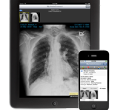 rsna 2013 inteleconnect patterns intelerad software pacs accessories remote