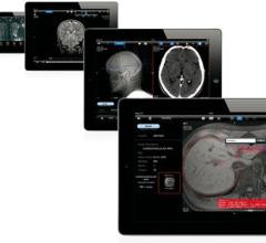 remote viewing systems software mobile devices rsna 2013 aycan