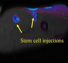 NIH Researchers Discover New Method to Label Cells for MRI Tracking 