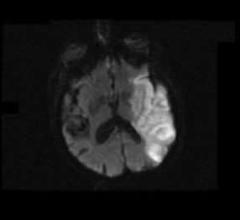 Oxygen Biotherapeutics, Aurum Biosciences Explore Imaging, Therapeutic Uses of Oxycyte PFC 