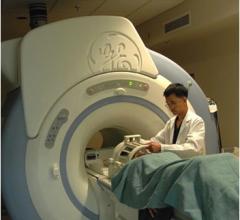 NIH, stroke, MRI, CT, screening, door-to-treatment time, SMART study