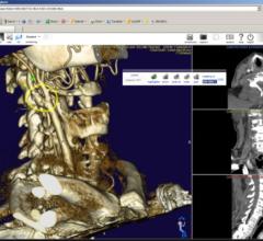 Nil 4.0, PACS 3.0, Claron Technology, remote viewing systems, RSNA 2014