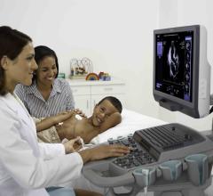 Siemens FDA Clearance ACUSON SC2000 Prime Ultrasound System