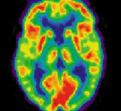 PET Census: Slower But Continued Growth in PET Patient Studies (2008 to 2010)