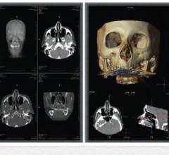 pacs accessories radiology information system rsna 2013 primordial PRISM