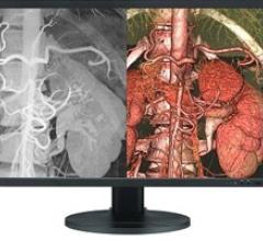 Quest Introduces Its Next Generation AlphaView 4 MP Medical LCD