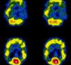  radioisotope