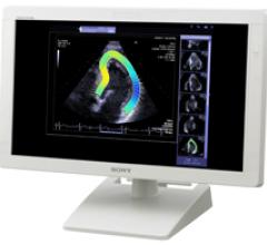 Sony Shows Medical Monitor Utilizing New OLED Technology 