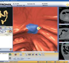 icad veralook colonoscopy ct systems software mri computer aided RSNA 2013