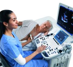 Lumason, CMS, ultrasound contrast agent, approval for reimbursement