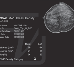 mammography systems women's healthcare vucomp m-vu breast density