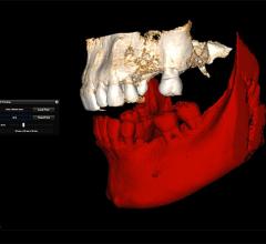 vizua 3d systems software rsna 2013 advanced visualization