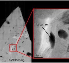 X-Ray Imaging Cornell University Research Bone Fractures Cracks