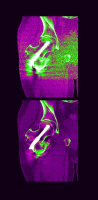 MRI Systems Orthopedic Imaging