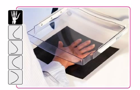 Sectra OneScreen Mammography Women's Healthcare 