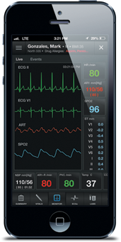 ECG wireless remote access software device