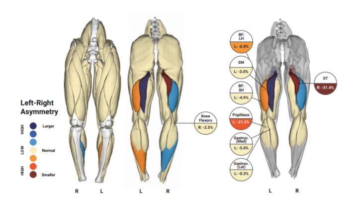 Immunis, Inc. has announced that a partnership with Springbok Analytics to implement their MRI-based AI muscle analysis technology in its Phase 1/2a Clinical Trial, assessing the efficacy of its novel secretome therapeutic (IMMUNA) in targeting sarcopenia.