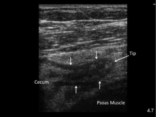 Point of Care Ultrasound Systems CT Scans