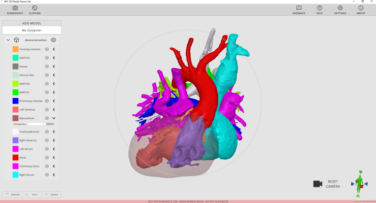 Arc Viewer 3D Image of Heart