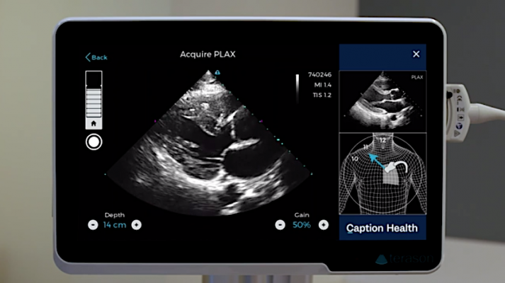 Point of Care Ultrasound Technology (POCUS) With AI