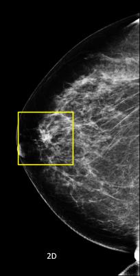 Hologic Showcases 3-D Mammography, Advanced Imaging Technologies at RSNA 2012